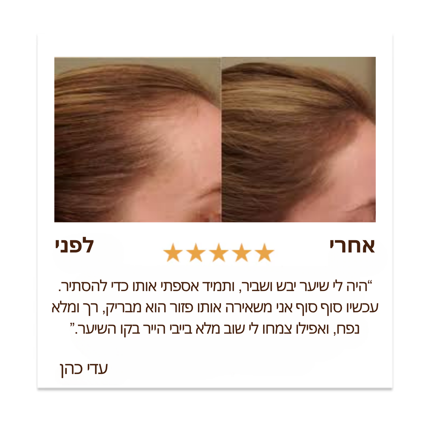 שמן באטאנה טבעי לצמיחת שיער