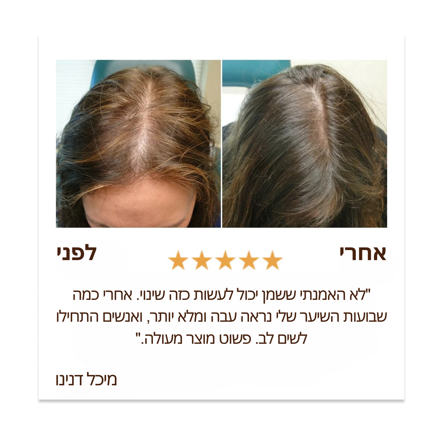 שמן באטאנה טבעי לצמיחת שיער